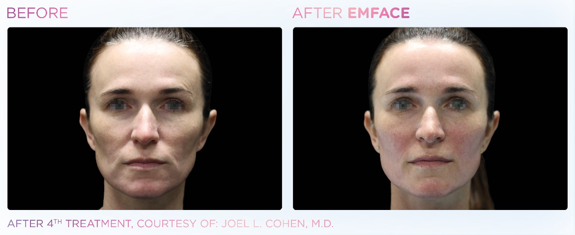 Emface_PIC_Ba-card-female-face-057_ENUS100-1