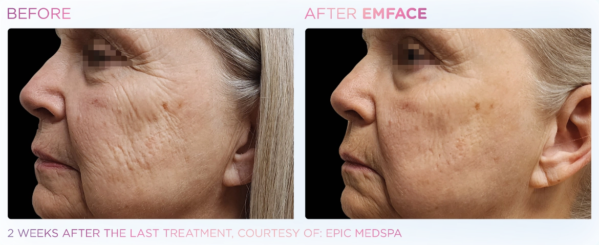 Emface_PIC_Ba-card-female-face-107_ENUS100-1